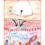 Ago Microterapia c/Campana Sit